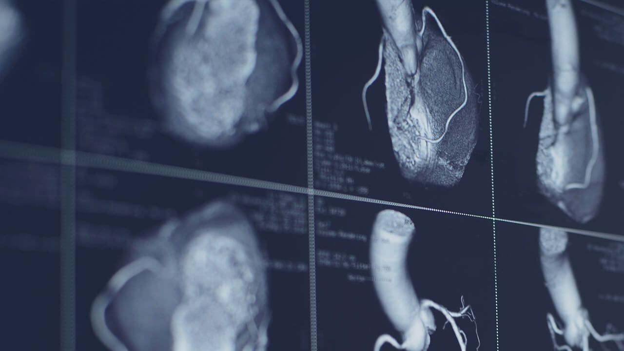 Close-up of medical monitor screens displaying cardiac and vascular scan imagery