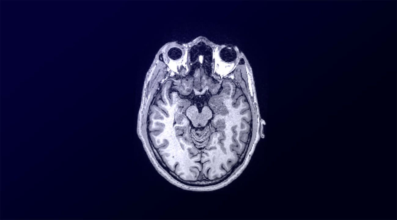 Close-up of a human brain